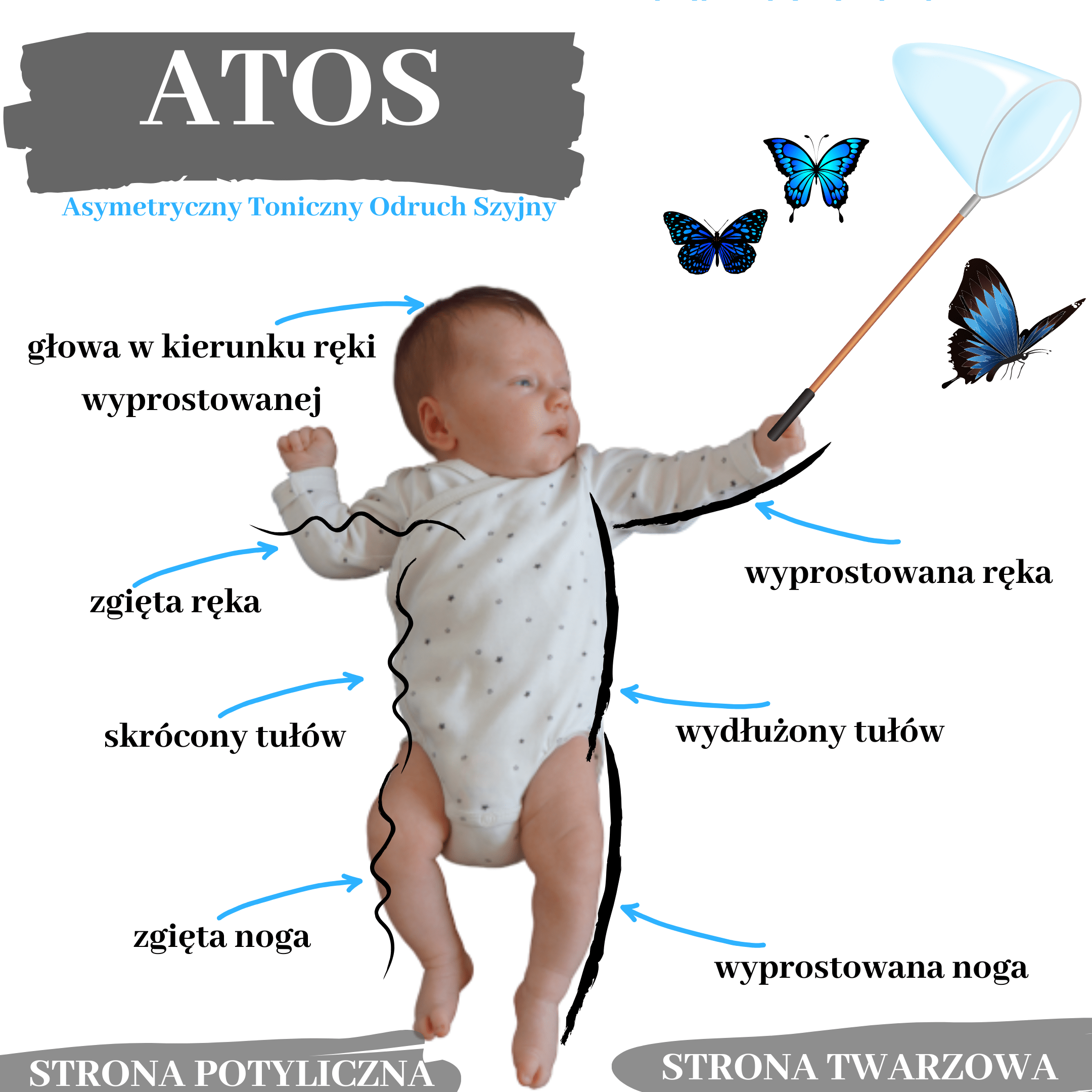 Cechy charakterystyczne odruchu ATOS